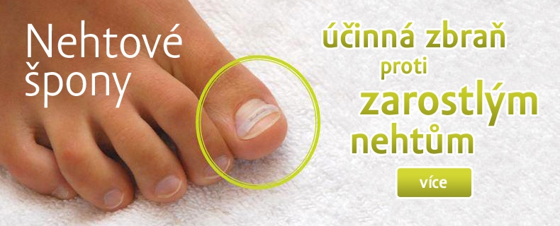 Nehtové špony